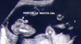 genitalia