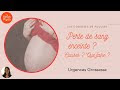 Debut De Grossesse Et Perte De Sang / Grossesse Quels Sont Les Symptomes A Surveiller / La perte blanche crémeuse encore appelée leucorrhée connue pour faciliter les rapports sexuels peut se révéler être une infection dans certains cas.