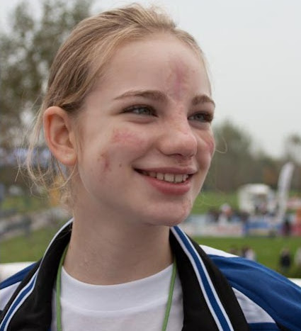 Beatrice Vio Lo Sport Insegna