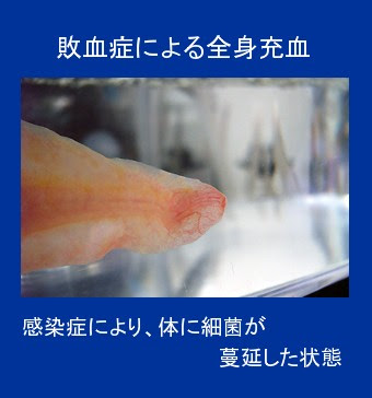 だらだら馬日記 ウーパールーパーの病気