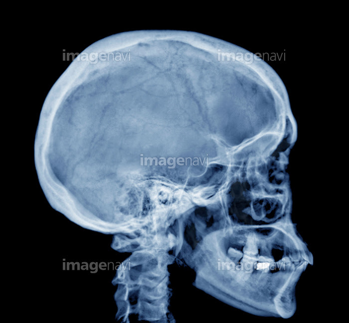 横顔 頭部 関節 頭蓋骨 人体解剖学 生物学 の画像素材 写真素材ならイメージナビ