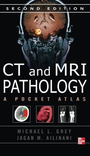 CT & MRI Pathology: A Pocket Atlas, Second Edition, by Michael Grey, Jagan Ailinani