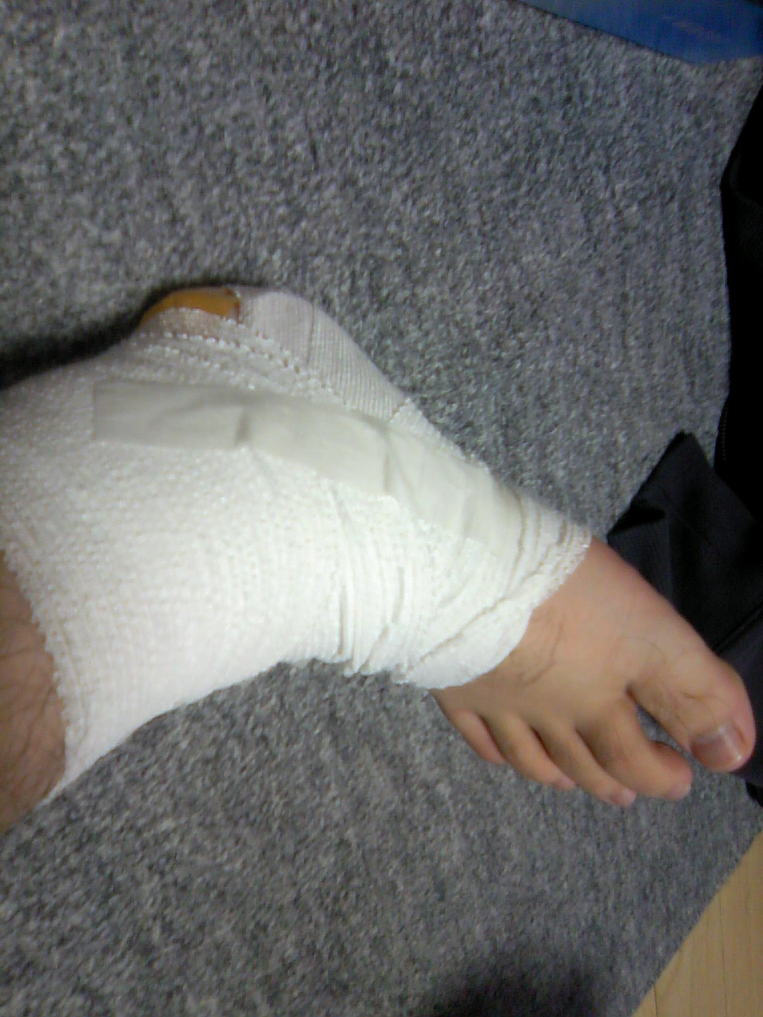 靴ずれにやられた1週間 とあるネットワーク屋の日常