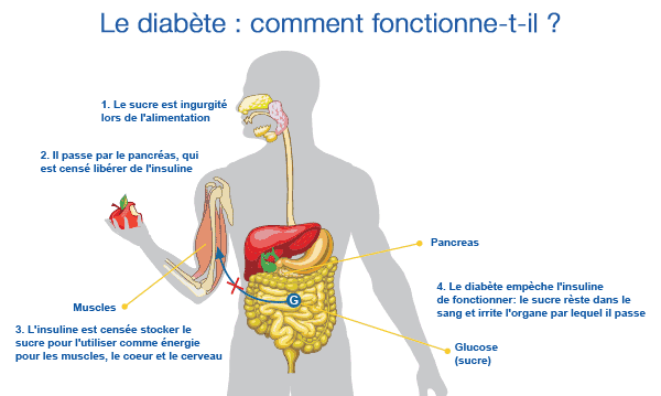 Diabte de type - Dfinition, Symptmes, Traitements