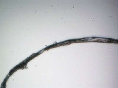 morgellons observations 4