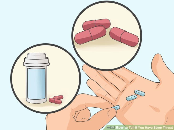 Tell if You Have Strep Throat Step 26 Version 2.jpg