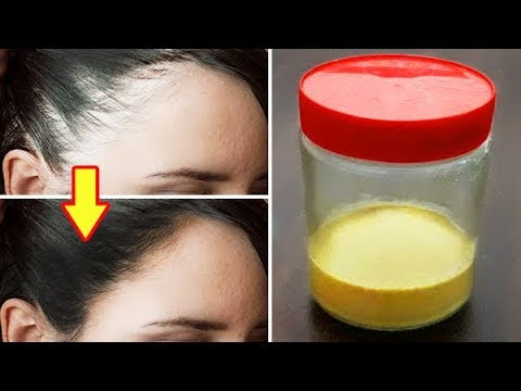 Video 3 وصفات سهلة لعلاج الصلع وإنبات الشعر من جديد