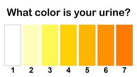  abnormal urine color chart