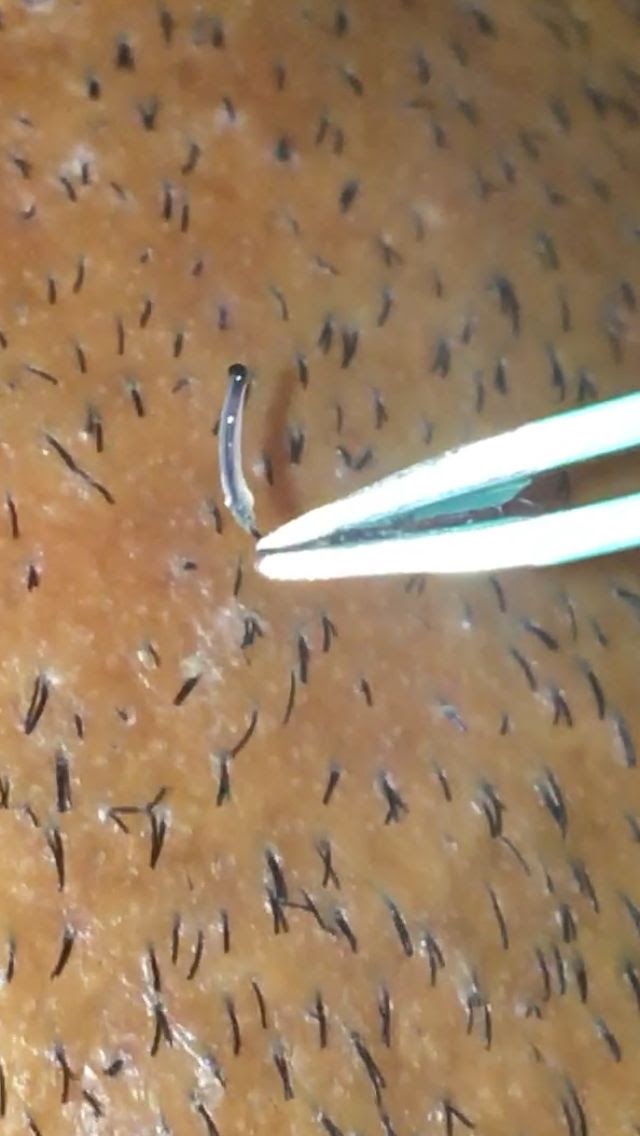 Cholesterol Treatment For Hair : AFRICANEXPORT'S BLOG: CHOLESTEROL FOR YOUR HAIR, NOT YOUR HEALTH.