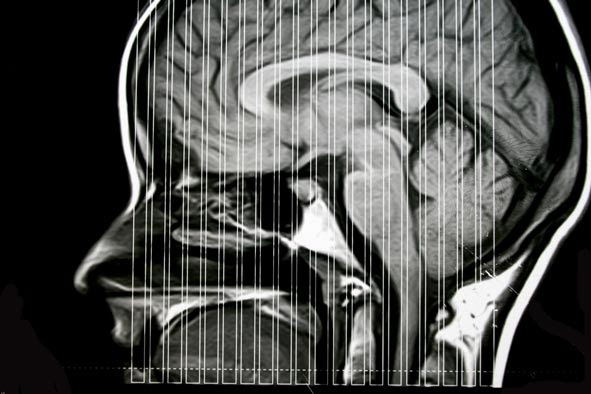 MRI brain scan mri brain scan. MRI brain scan