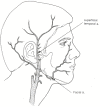 Figure 18.2. Arrows indicate points of manual compression of the right superficial temporal and facial arteries.