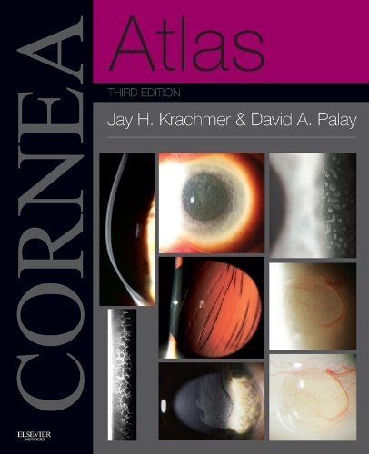 Cornea Atlas (Expert Consult), by Jay H. Krachmer, David A Palay