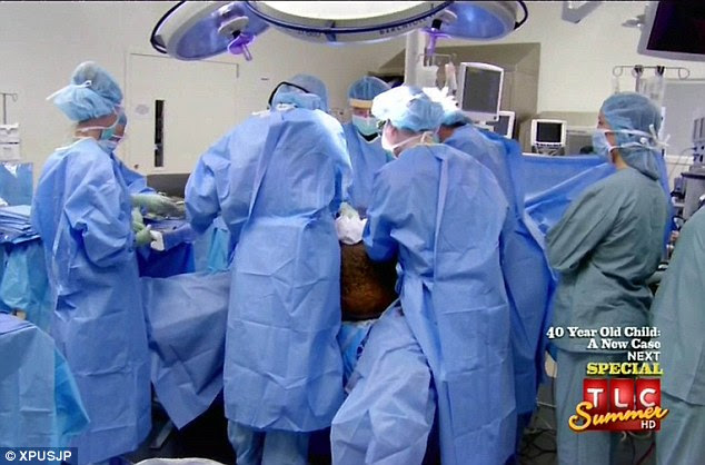 A team of four physicians begin the procedure to remove Las Vegas man Wesley Warren's 132lbs scrotum