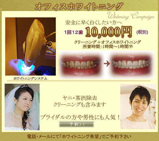 ホワイトニング キャンペーン 円 東京都世田谷区 デンタルオフィス下北沢