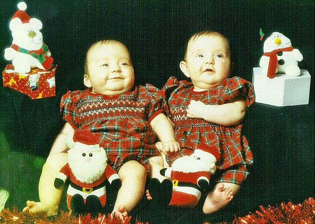 Record breakers: Bethany and Megan Shepherd as babies 11 years ago