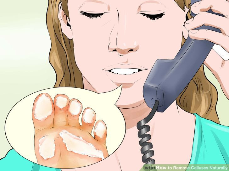 Remove Calluses Naturally Step 3 Version 2.jpg
