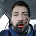 Shocking! Man's Face Got Blown Up After The E-cigarette He Was Smoking Exploded (Photos) -Wapvibes247.com