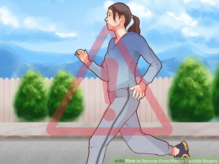 Recover From Plantar Fasciitis Surgery Step 15.jpg