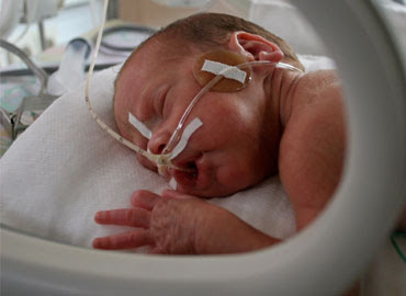 Bebes Prematuros 5 Meses Articulos Utiles Sobre El Embarazo