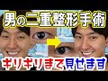 [10000ダウンロード済み√] ���ケメン 二重 255063-イケメ��� 二重 種類