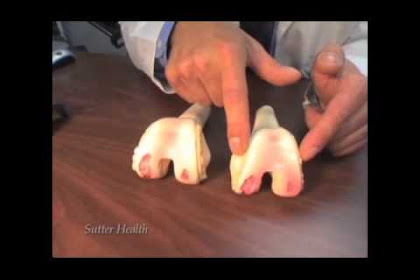 Home Remedies Knee Pain