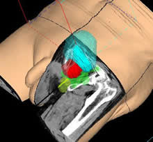 most cancers du foie remede naturel