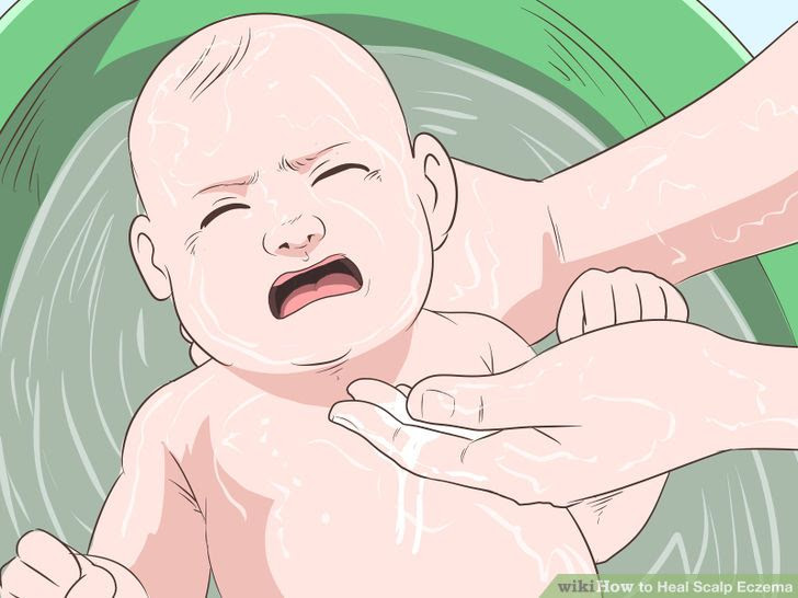 Heal Scalp Eczema Step 22 Version 3.jpg