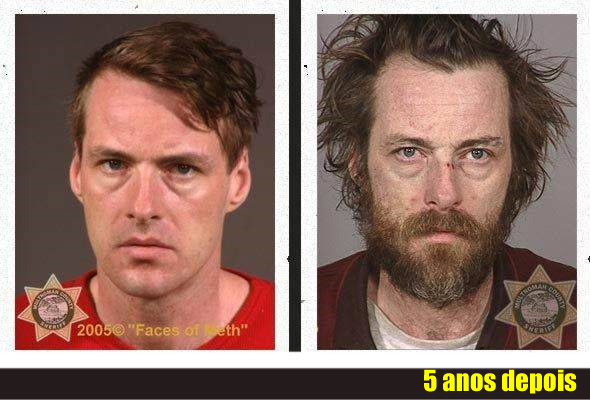 Fotos mostram como as drogas destroem a aparência física das pessoas