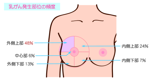 乳がんについて 乳腺外科 マンモグラフィ 乳がん検診 乳腺専門医 大阪府高槻市 りょうクリニックhp