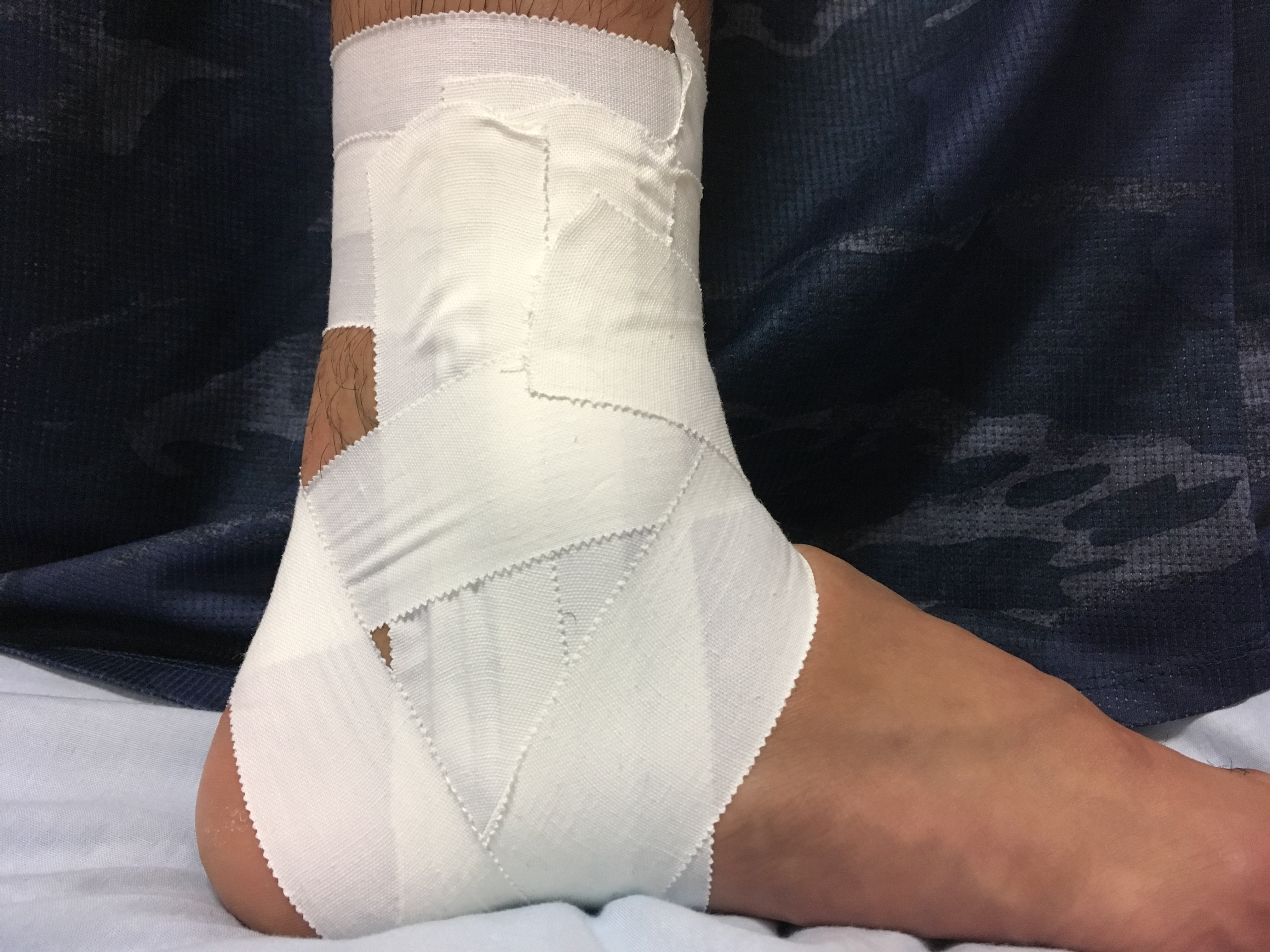 マネの技術vol 5 プレを支えるテーピングの方法編 Beyond ビヨンド 大学サッカー同好会情報を発信する全国唯一の情報サイト