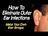 Ear Infections How To Treat