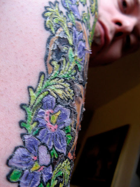  peeling tattooed flesh, taken yesterday day 5? soon after I woke up