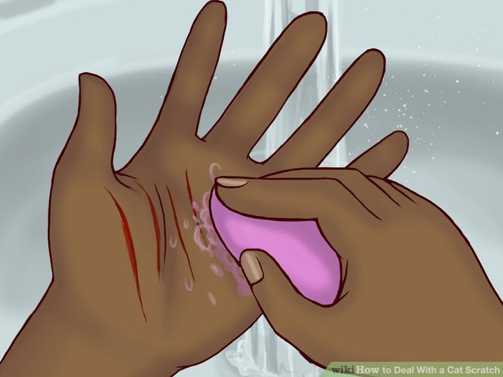 Deal With a Cat Scratch Step 12.jpg