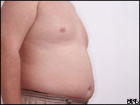 Obese man