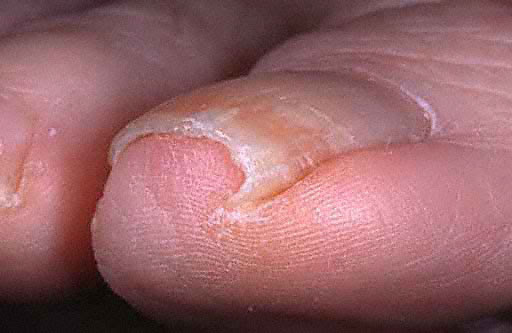 3 most common misbelieves about pedicure | Mont Bleu's ...