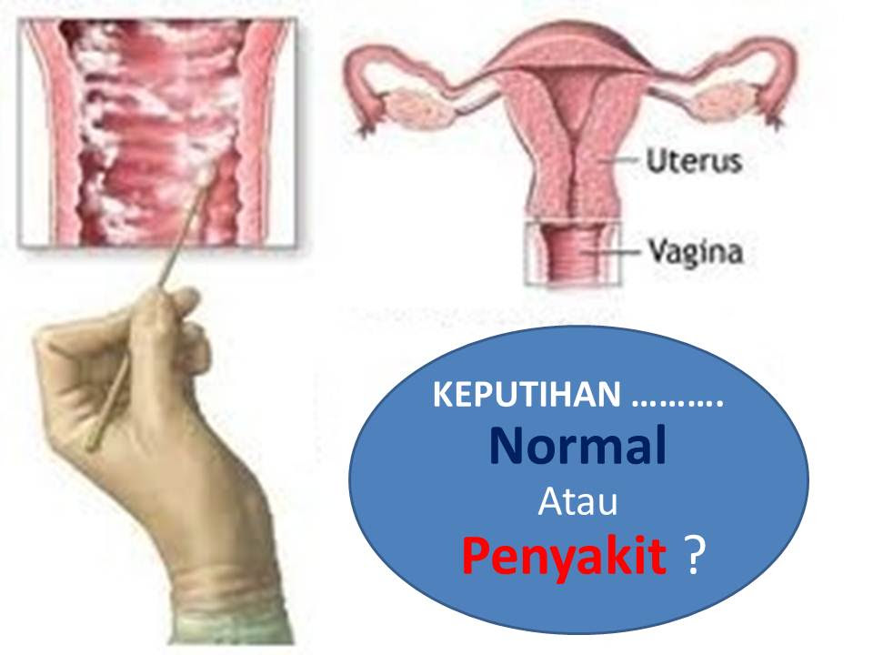 301 Moved Permanently