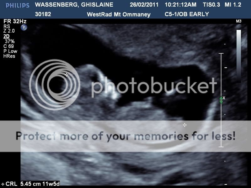 3d ultrasound pictures at 20 weeks. I am 21 +1 weeks and had a 3d