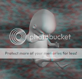 Ultrasound 10 Weeks Pregnant