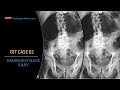 A 50 year old patient presented with  abdominal pain and vomiting  | FRCR GIT Radiology Case 02