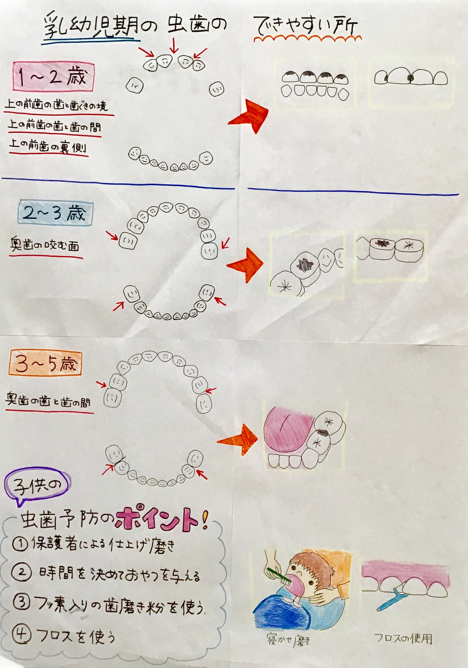 乳幼児期の虫歯のできやすい所｜宇佐市の歯科・歯医者なら、たきがみ 