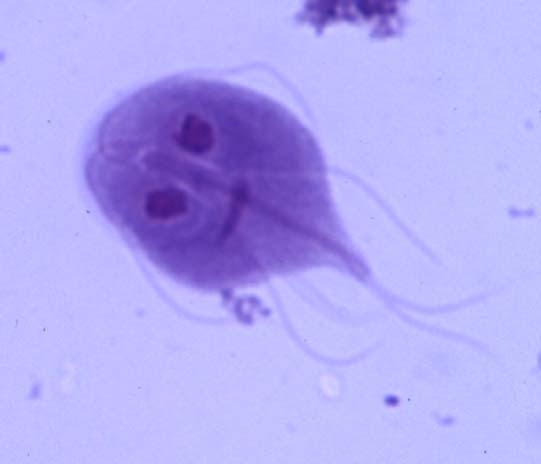 Giardia is a flagellated Giardia is a flagellated