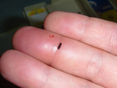 閲覧注意 指をトゲが10日かけてｼﾞﾜｼﾞﾜ貫通したでござるの巻 衝撃映像 上越に暮らすtakeさんの忘我混沌な日常