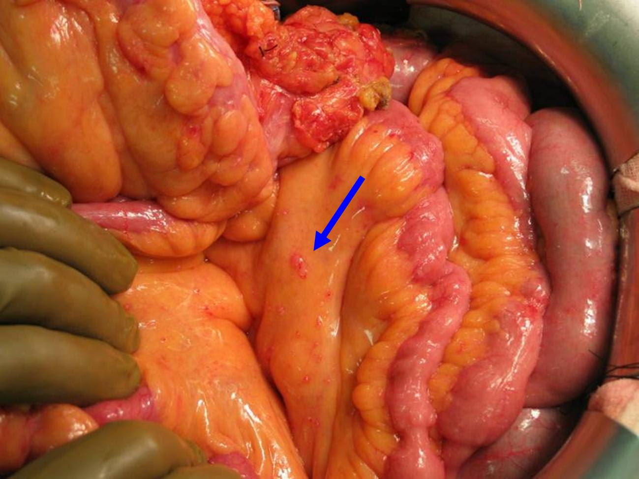 mesothelioma dog analysis