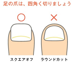 足の爪の切り方 クハラ整骨院のブログ