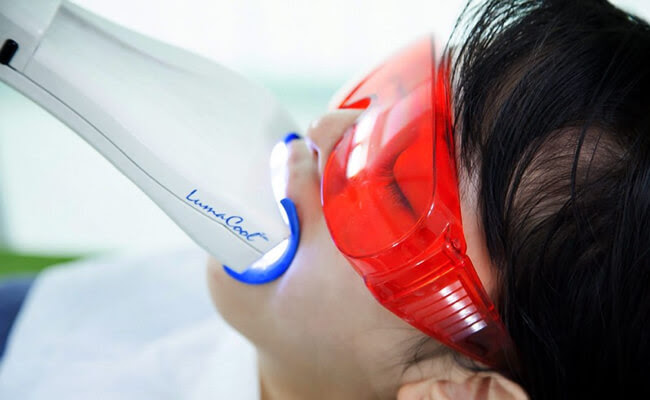 Холодное отбеливание зубов — белоснежно и безболезненно!