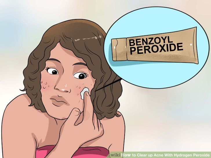 Clear up Acne With Hydrogen Peroxide Step 5 Version 2.jpg