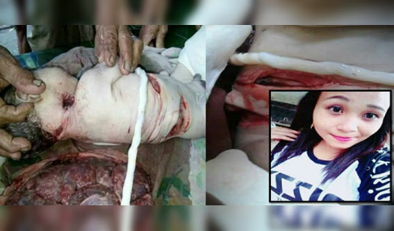 DUNIA AKHIR ZAMAN!!(ViraL) Panik Lahirkan Anak 'Luar Nikah' Seorang Diri, 'Ibu' Sembelih, Kerat dan Buang Bayi Sendiri.