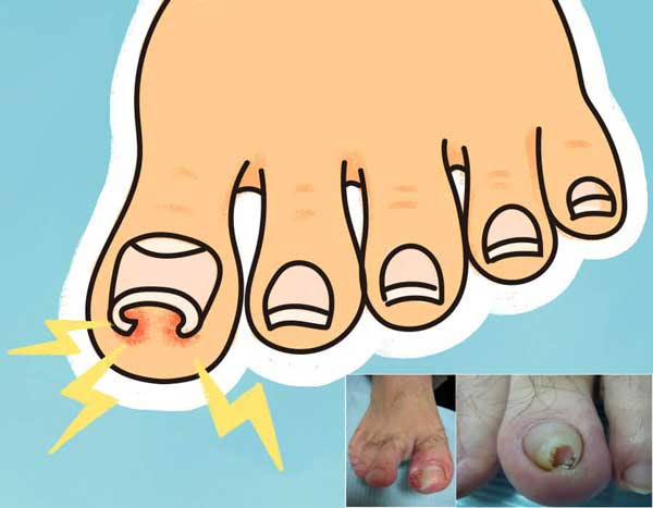 診療内容 足病 フットケア フットウェア インソール 福岡 六本松 足と心臓血管クリニック