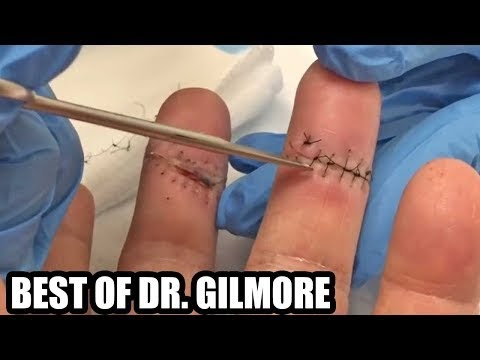 Dr. Gilmore's Best Hand & Nail Procedure!  BEST OF!