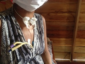 Sondas e tubos na traqueia são usadas pela dona de casa após radioterapia (Foto: Abinoan Santiago/G1)